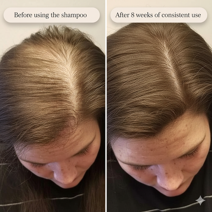 Tgideas – Anti Hair Fall Shampoo
