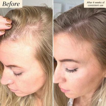 Tgideas – Anti Hair Fall Shampoo